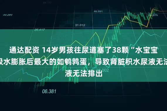 通达配资 14岁男孩往尿道塞了38颗“水宝宝”，吸水膨胀后最大的如鹌鹑蛋，导致肾脏积水尿液无法排出